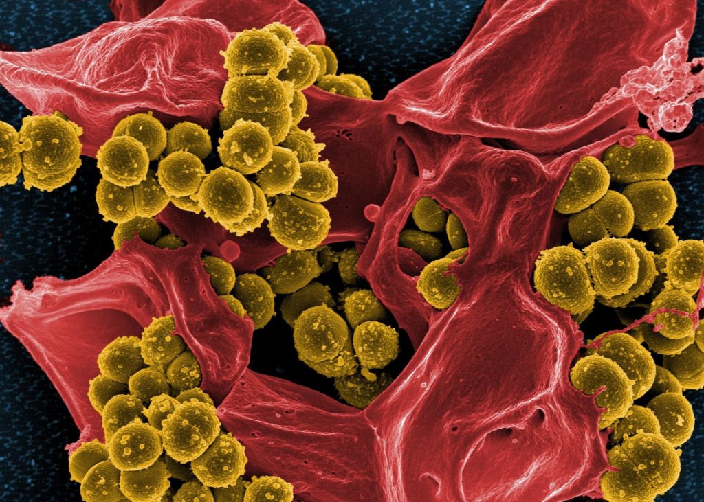 bakterija helicobacter