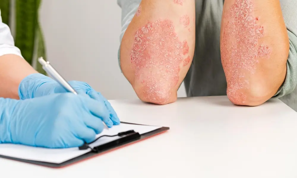 BIO CBD mazilo dermatološko testirano CBD mazilo pomiri in pospeši obnovo poškodovane kože.